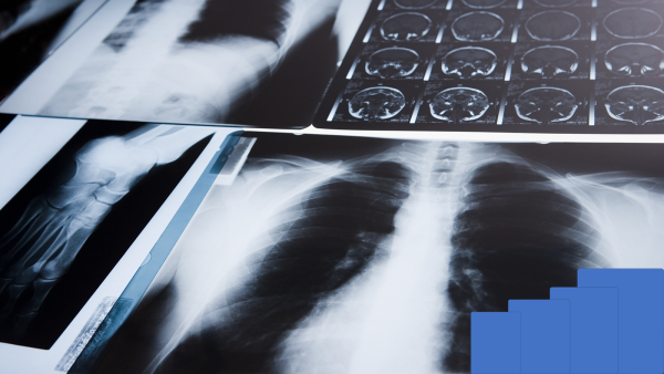 Thermal Solution is a Third-generation Innovation of Medical Imaging (e-Join)