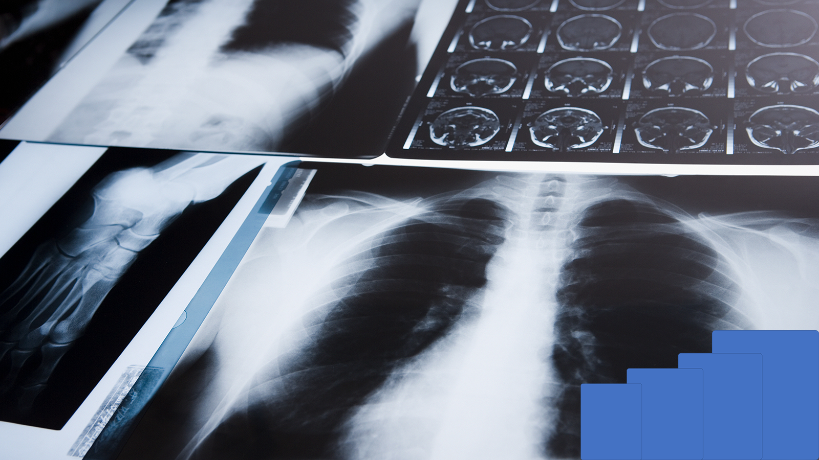Thermal Solution is a Third-generation Innovation of Medical Imaging (e-Join)