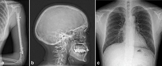 Image examples of a an upper arm, b a skull and c a thorax a.p. acquired with an MRD1417 for general radiography (e-Join)