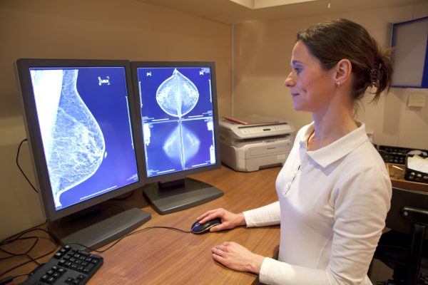 Full-field digital mammography (FFDM) (e-Join)
