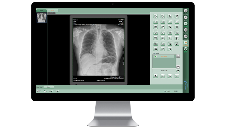 Workstation Printing Function of Fixed Floor-mounted Medical Digital Radiography X-ray Machine DF6500