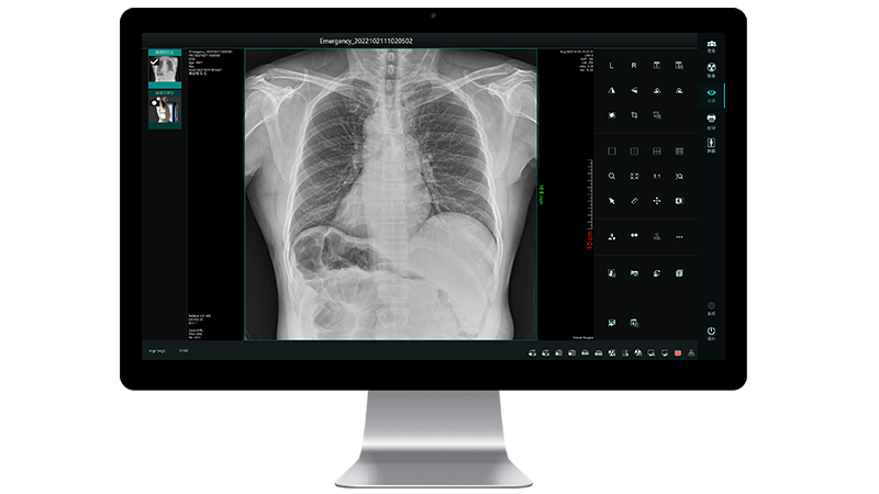 Workstation of Medical Mobile Digital Radiography X-ray Imaging System DM8300