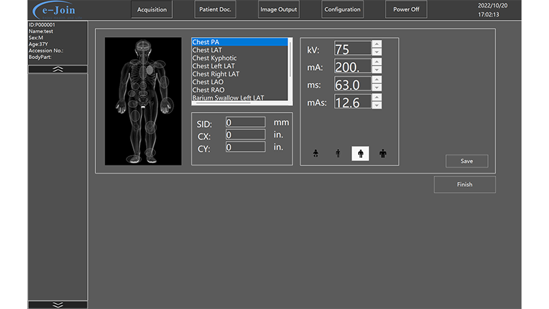 Workstation Exposure Function of Medical Digital Radiography Portable X-ray Machine DP5600