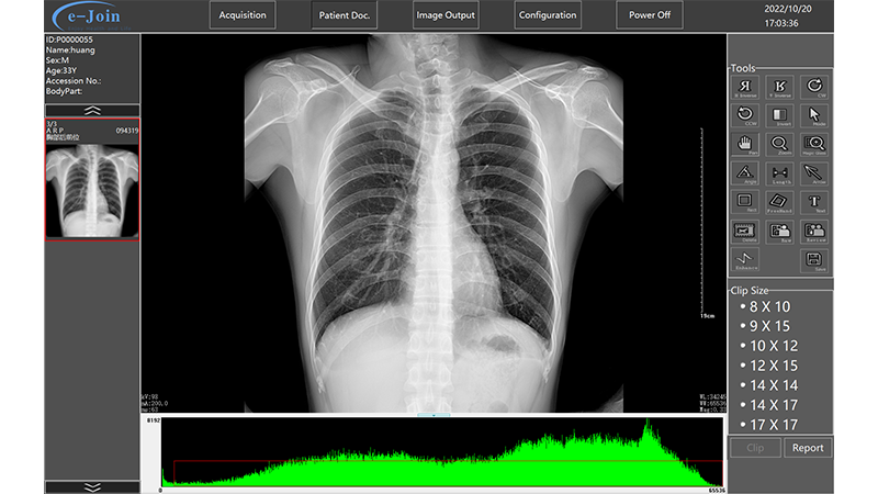 Workstation Processing Function of Medical Digital Radiography Portable X-ray Machine DP5600