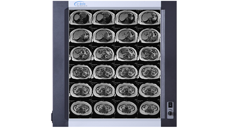 MRI Image of 320 dpi High Quality Tabletop Digital Thermal DICOM Imaging Film Printer DT300