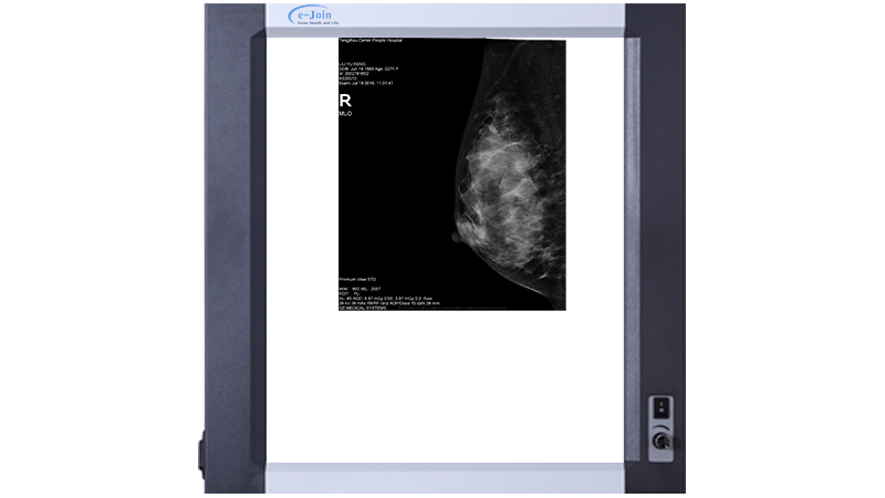 Mammography Image of 508 dpi Medical Radiography X-ray Thermal Imaging Film Camera DT500