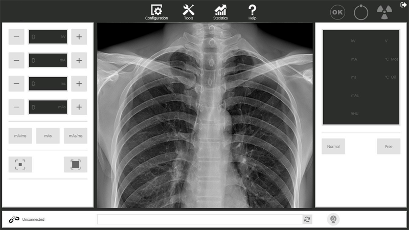 Background Software of AC Powered Portable High-frequency Medical X-ray Generator EXB56
