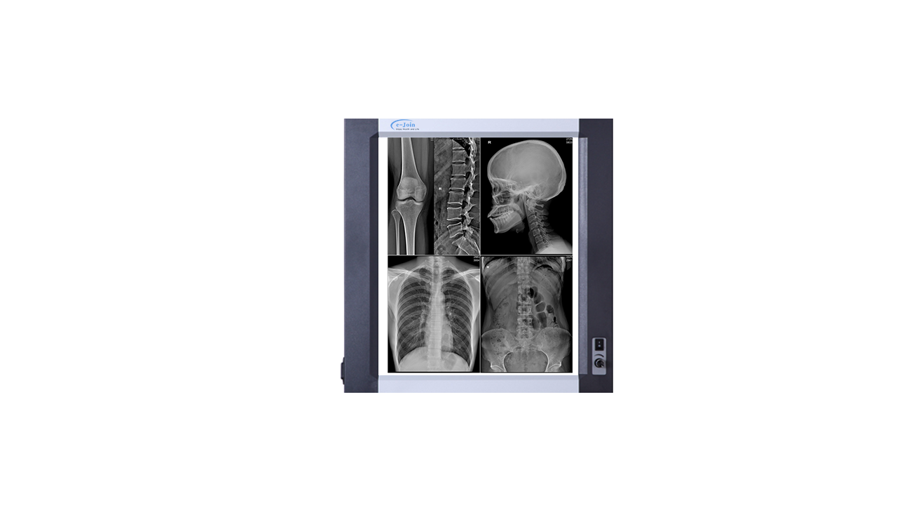 X-ray Image of Single High‐strength Ultra-thin Medical X-ray Dry Film Viewer FV1417