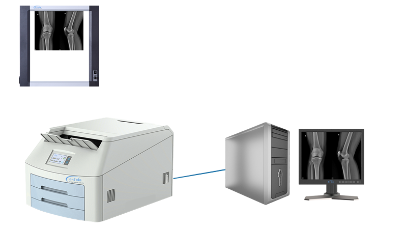 Application of Single High‐strength Ultra-thin Medical X-ray Dry Film Viewer FV1417