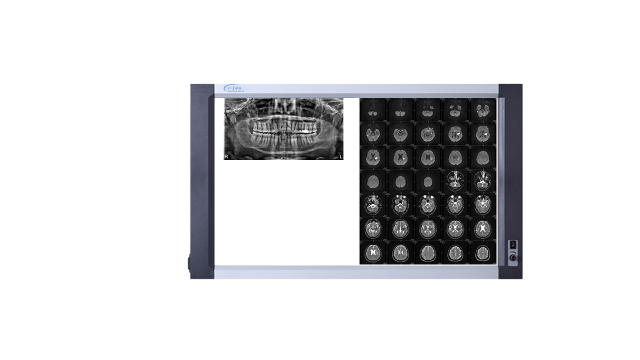 MRI Image of Dual High‐strength Ultra-thin Medical X-ray Dry Film Viewer FV2817