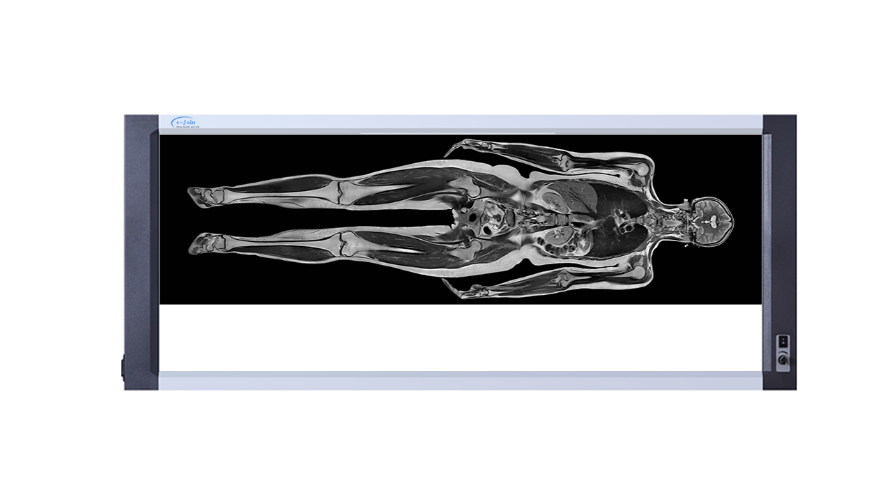 Body Image of Triple High‐strength Ultra-thin Medical X-ray Dry Film Viewer FV4217