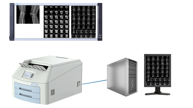 Application of Triple High‐strength Ultra-thin Medical X-ray Dry Film Viewer FV4217