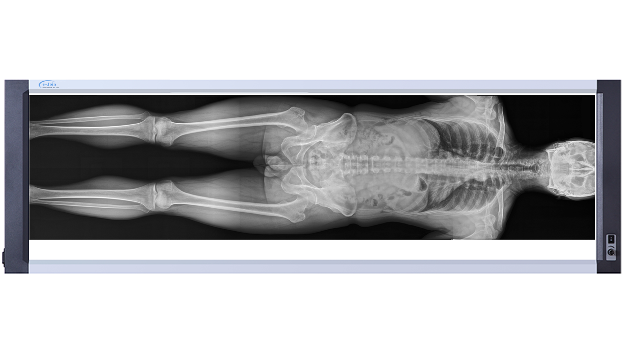 Body Image of Quadruple High‐strength Ultra-thin Medical X-ray Dry Film Viewer FV5617