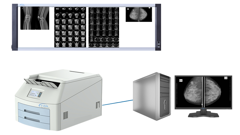 Application of Quadruple High‐strength Ultra-thin Medical X-ray Dry Film Viewer FV5617