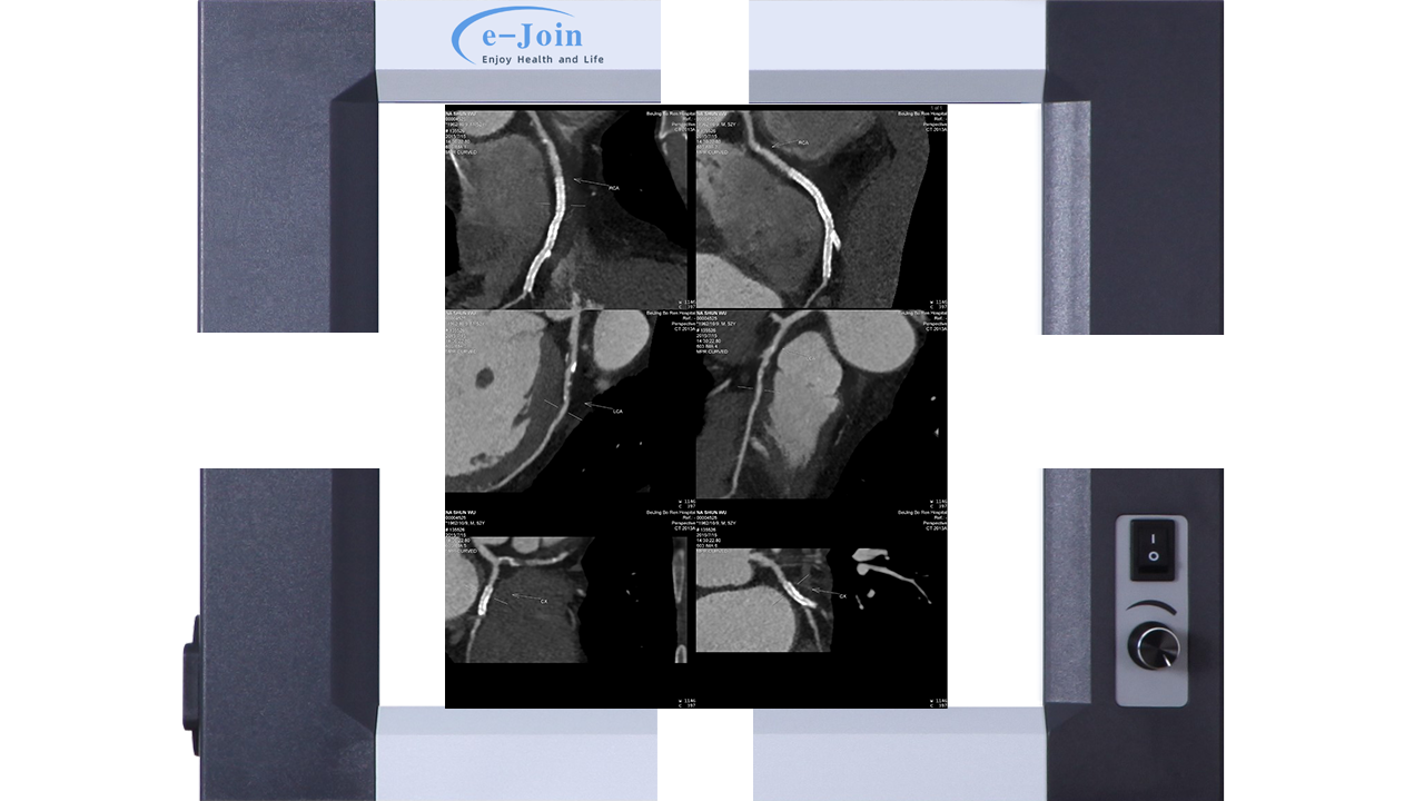 Structure Drawing of High‐strength Ultra-thin Medical X-ray Dry Film Viewer