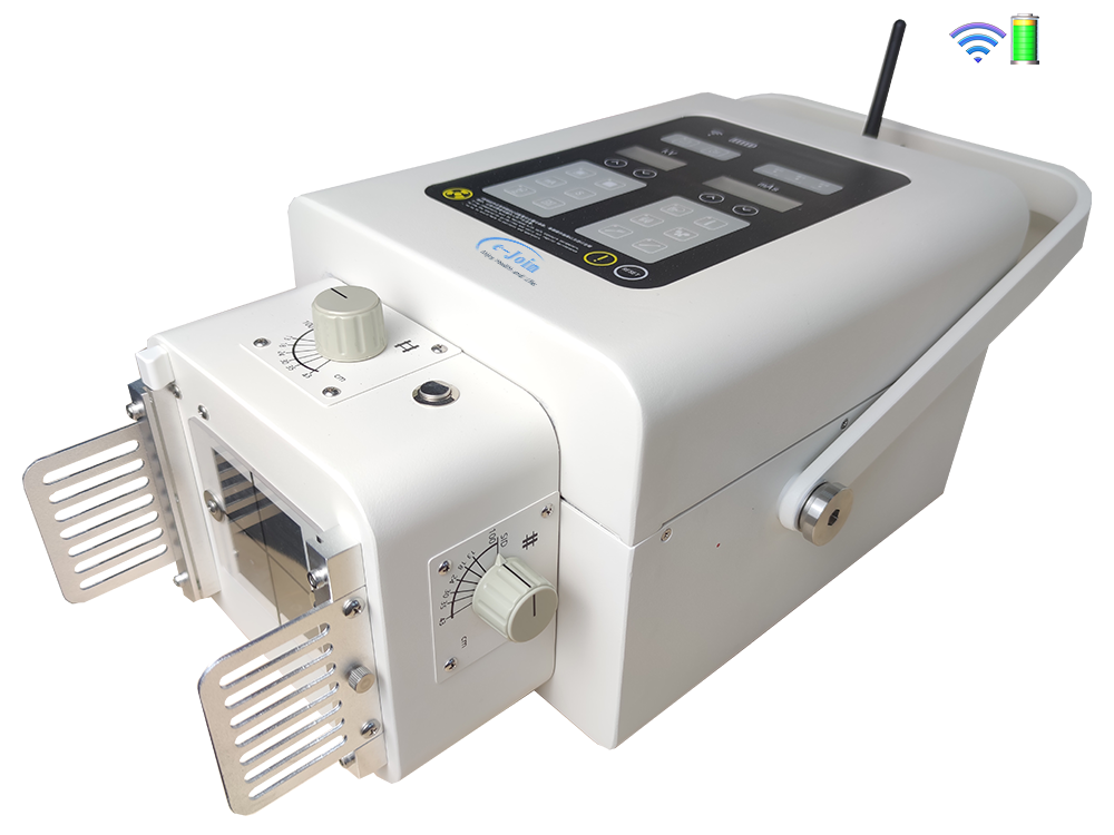INB56, WIFI Battery-powered Portable High-frequency Medical X-ray Generator (e-Join)