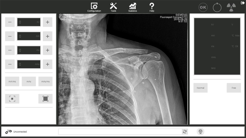 Background Software of WIFI Battery-powered Portable High-frequency Medical X-ray Generator INB56