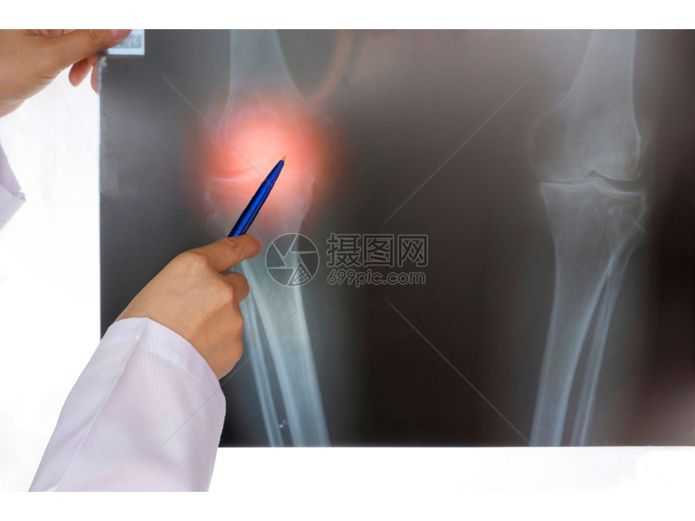 WIFI Battery-powered Portable High-frequency Medical X-ray Generator INB56 for Stationary Hospitals