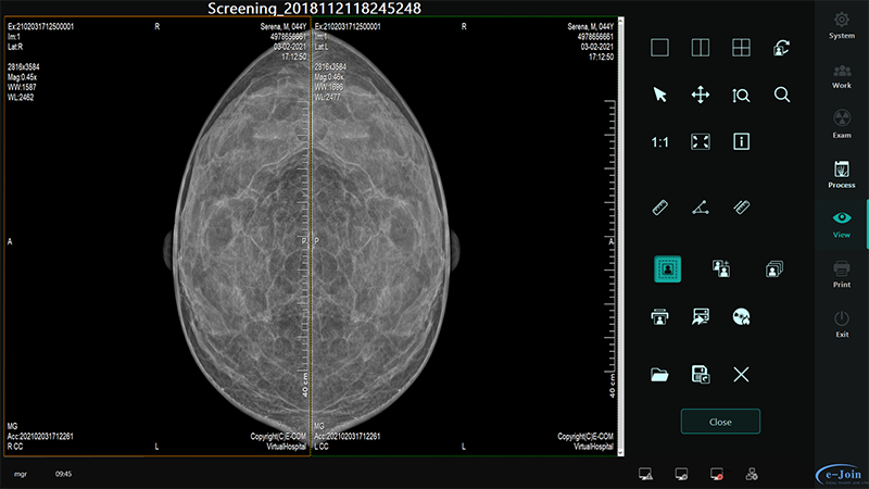 Workstation of CsI Full Field Digital Wired Mammography Diagnostic X-ray Imaging Flat Plate MMD0810