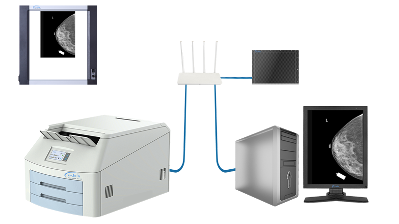 Instant Digital Retrofit of CsI Full Field Digital Wired Mammography Diagnostic X-ray Imaging Flat Plate MMD0810