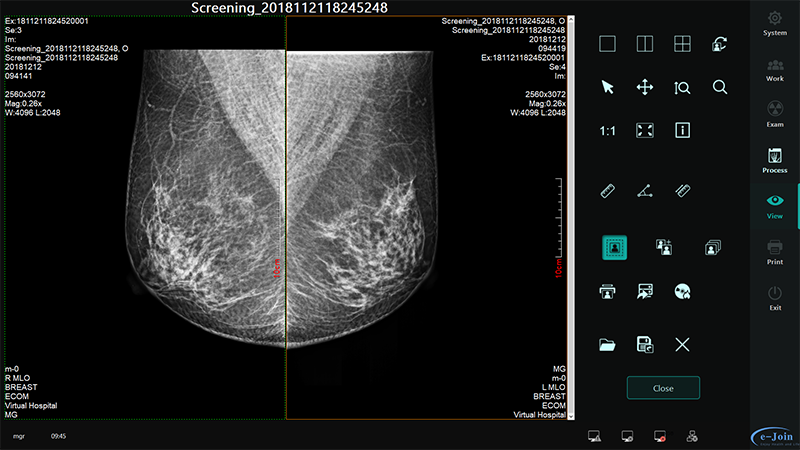 Workstation of CsI Full Field Digital Wired Mammography Diagnostic X-ray Imaging Flat Plate MMD1012