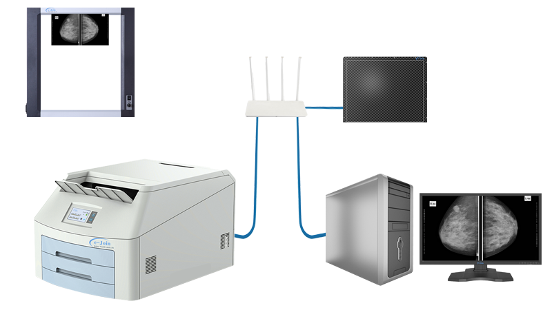 Workstation of CsI Full Field Digital Wired Mammography Diagnostic X-ray Imaging Flat Plate MMD1012