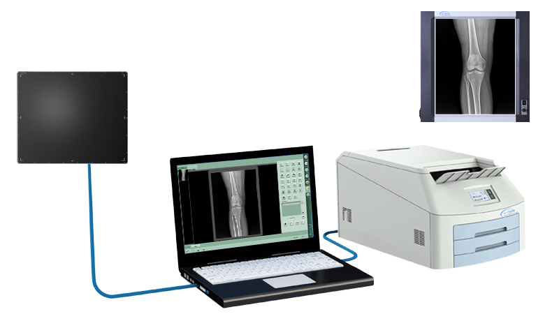 Instant Digital Retrofit of GOS or CsI Wired Fixed Medical Digital X-ray Image Flat Panel Detector MRD1417