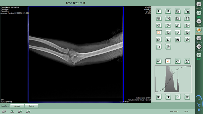 Workstation of GOS or CsI Wired Fixed Medical Digital X-ray Image Flat Panel Detector MRD1717