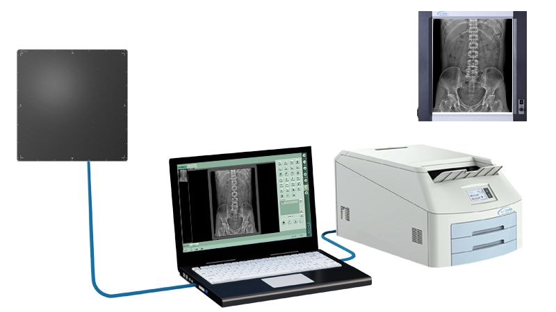 Instant Digital Retrofit of GOS or CsI Wired Fixed Medical Digital X-ray Image Flat Panel Detector MRD1717