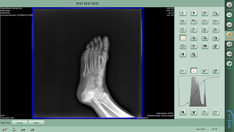 Workstation of GOS or CsI Wireless Mobile Medical Digital X-ray Image Flat Panel Detector MRL1417