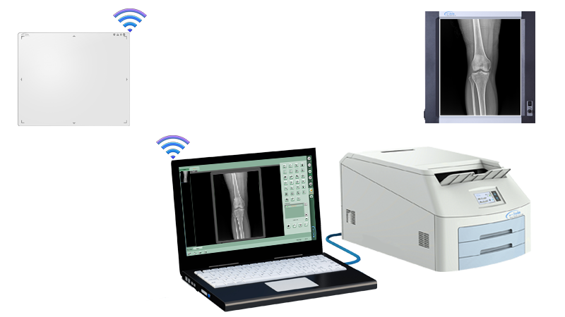 Instant Digital Retrofit of GOS or CsI Wireless Mobile Medical Digital X-ray Image Flat Panel Detector MRL1417