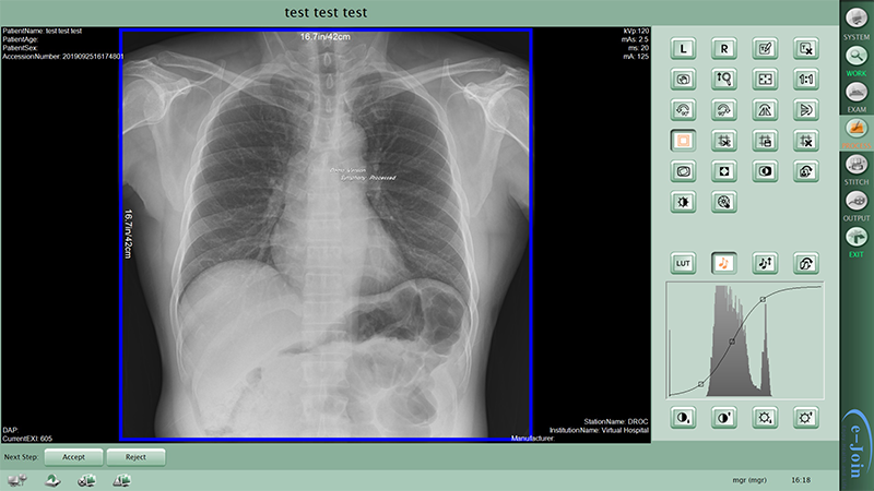 Workstation of GOS or CsI Wireless Mobile Medical Digital X-ray Image Flat Panel Detector MRL1717
