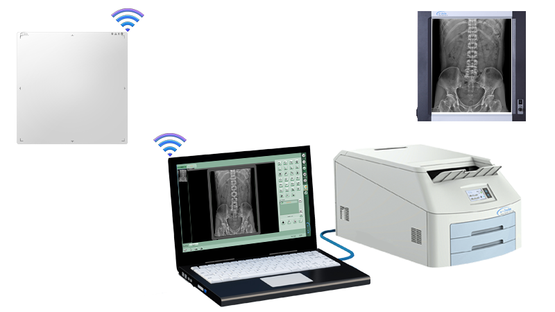 Instant Digital Retrofit of GOS or CsI Wireless Mobile Medical Digital X-ray Image Flat Panel Detector MRL1717