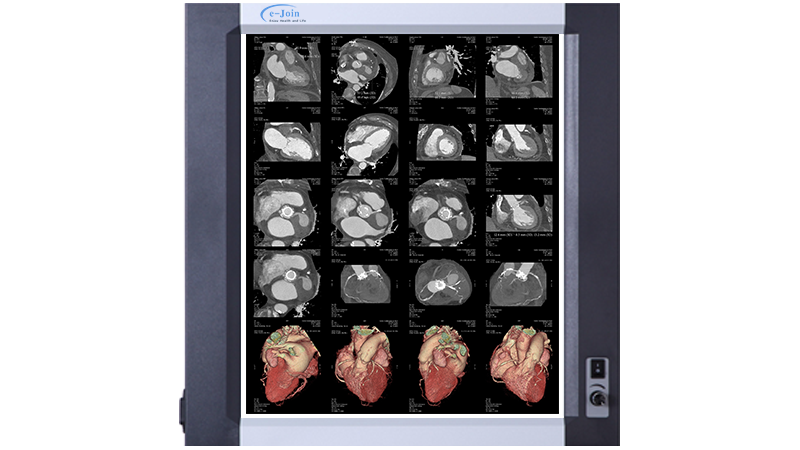 3D Reconstruction Image of Medical Dry X-ray Imaging Clear inkjet Printing White Film