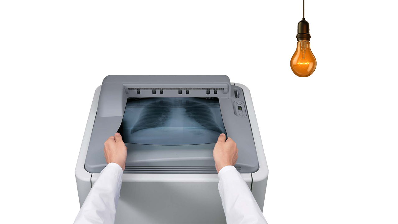 Elegant Appearance of Medical Dry X-ray Imaging Clear Blue Base Laser Film