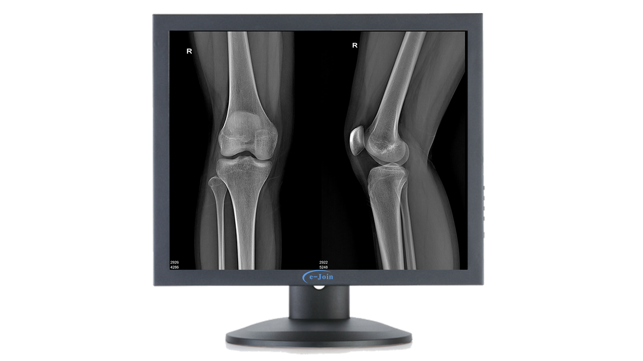 Bone Image of Flexible LED Medical Digital Diagnostic Color Display Screen Monitor RC10