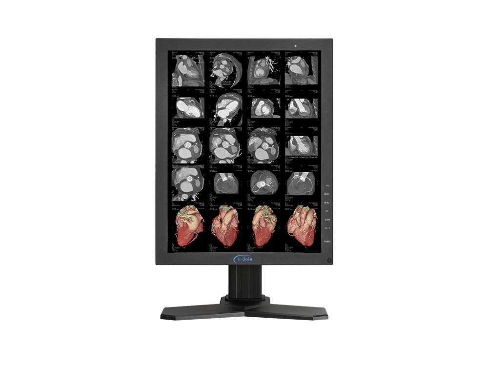 RC32, 3M 21.3'', HDMI LED Medical Digital Diagnostic Color Display Screen Monitor (e-Join)