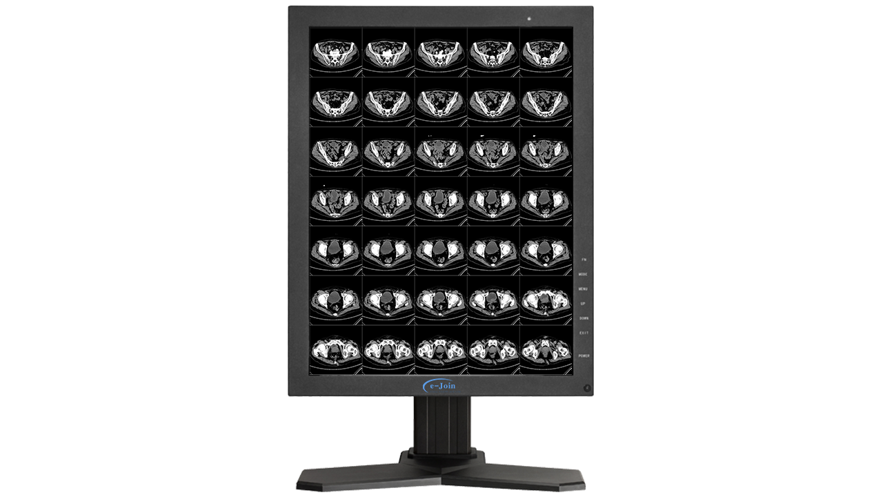 HDMI LED Medical Digital Diagnostic Color Display Screen Monitor RC32 for MRI Image