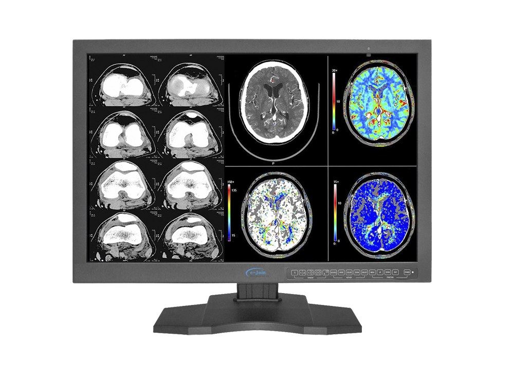 RC42, 4M 30'', Lager LED Medical Digital Diagnostic Color Display Screen Monitor (e-Join)