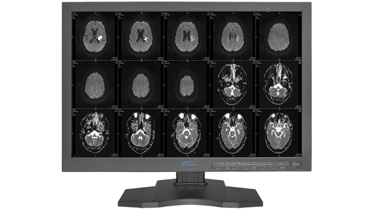 Lager LED Medical Digital Diagnostic Color Display Screen Monitor RC42 for MRI Image
