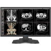 RC85, 8M 31.5'', Big HD HDMI LED Medical Digital Diagnostic Color Display Screen Monitor (e-Join)