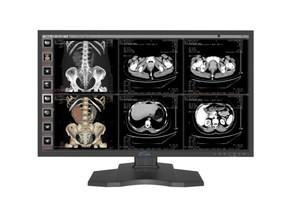 RC85, 8M 31.5'', Big HD HDMI LED Medical Digital Diagnostic Color Display Screen Monitor (e-Join)