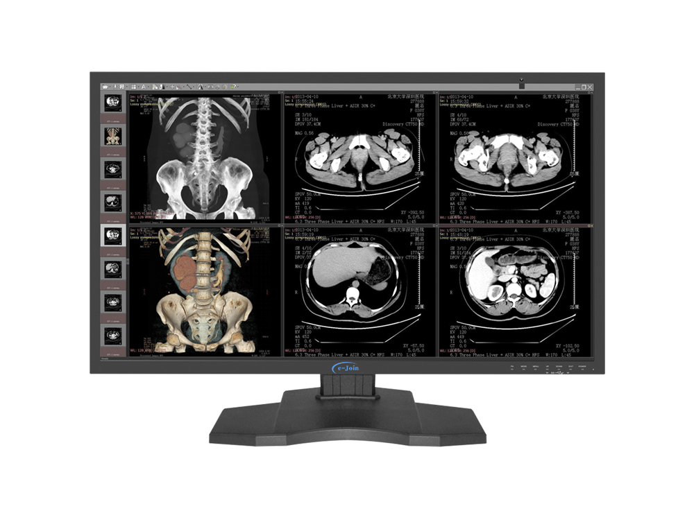 RC85, 8M 31.5'', Big HD HDMI LED Medical Digital Diagnostic Color Display Screen Monitor (e-Join)