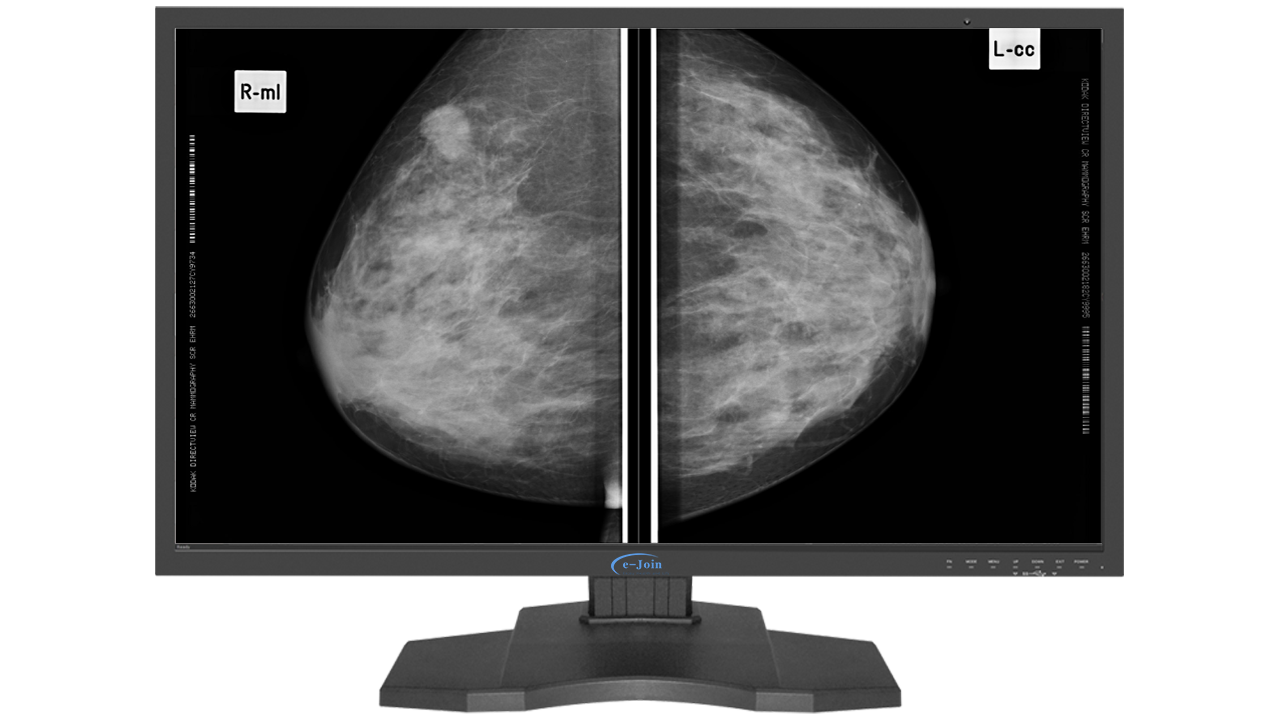 Big HD HDMI LED Medical Digital Diagnostic Color Display Screen Monitor RC85 for Mammography Image