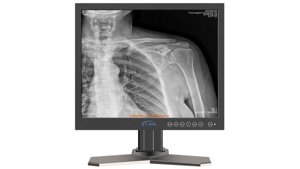 RG17 - HDMI LED Medical Radiology X-ray Grayscale Display Screen ...
