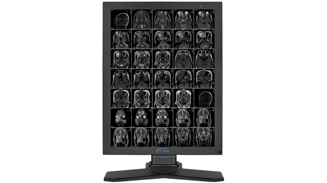 LED Medical Mammography Radiology X-ray Grayscale Display Screen Monitor RG52 for MRI Image