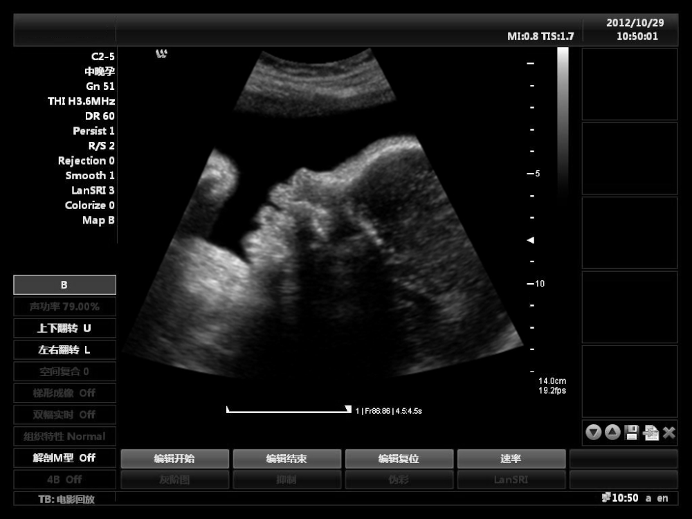 Infant Ultrasound Image of Medical Thermal Diagnostic Imaging Dry Clear Ultrasound Paper UTP110