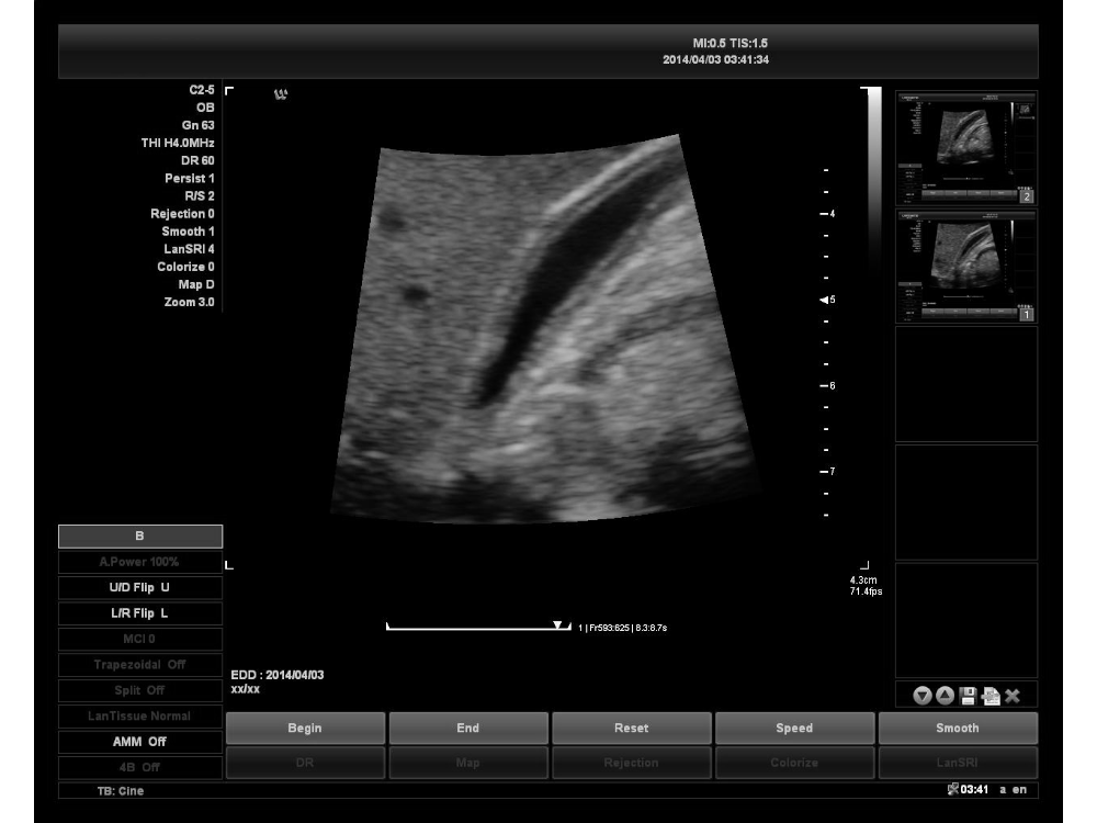 Bady Ultrasound Image of Medical Thermal Diagnostic Imaging Dry Clear Ultrasound Paper UTP110