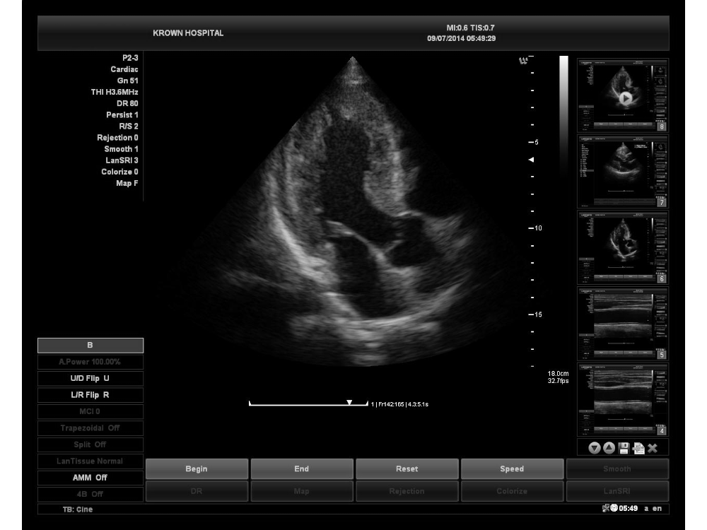 Trottie Ultrasound Image of Medical Thermal Diagnostic Imaging Dry Clear Ultrasound Paper UTP110