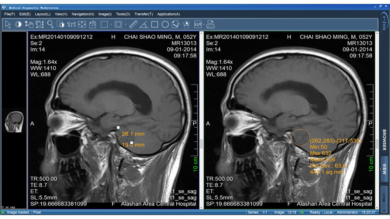 Universal Medical Image Workstation of eMini PACS